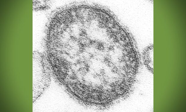 Measles exposure reported at Sea-Tac Airport; health officials urge vaccination check